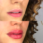 Lip tattoo