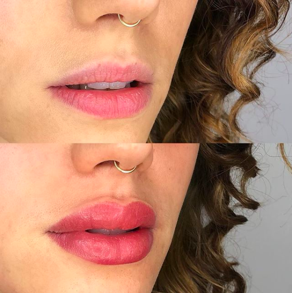 Permanent lip color enhances naturally pale tissue provides definition  and corrects uneven lips  Erin Meier Aesthetics