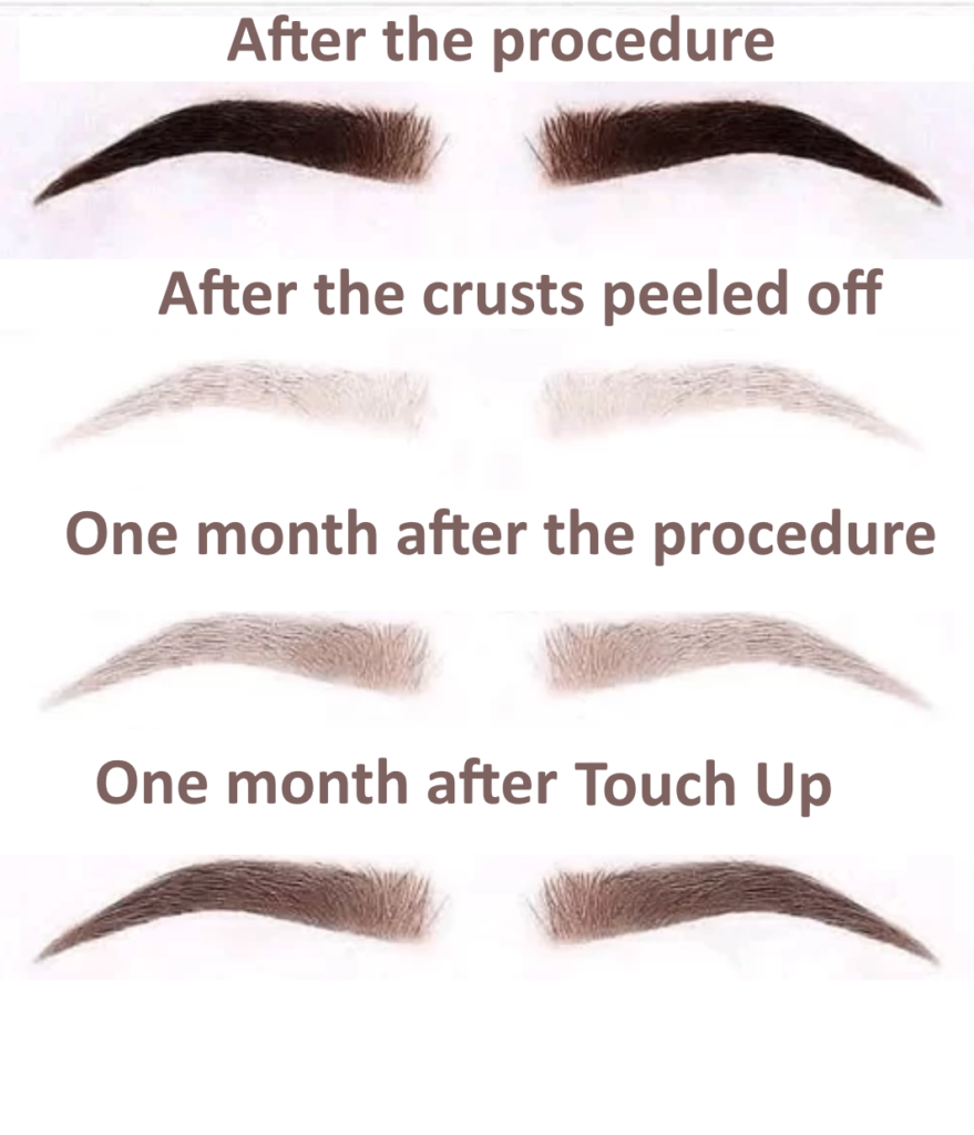 Before and after Eyebrow Tattooing