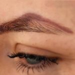 eyebrow tattoo removal
