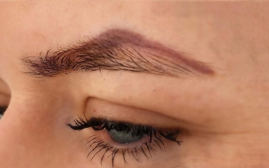 The details of the eyebrow laser tattoo removal process  Elite Look