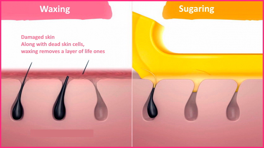 waxing vs sugaring